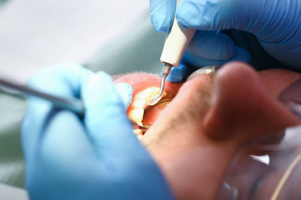 Best Urgent Care for Lost Fillings or Crowns in La Follette, TN